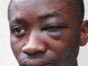 Parma - Ghanaian boy up beated